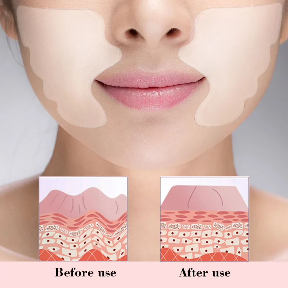 Facial Wrinkle Remover Pad Reusable Medical Grade Silicone Nasolabial Folds Anti-aging Mask Prevent Wrinkle Skin Lifting Patches - Image 3