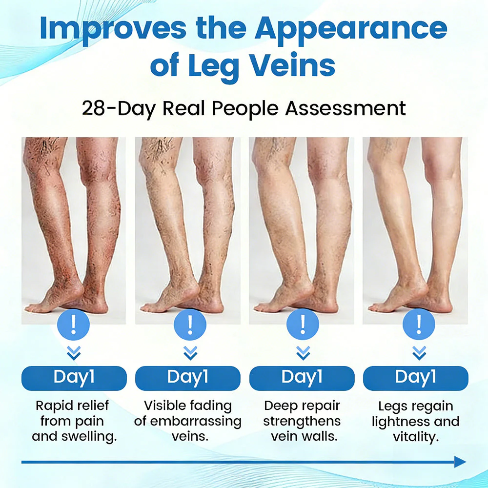 🇬🇧🎯🌿GFOUK® VascuCare Vein Healing Spray(Designed for Varicose veins, Spider veins, Deep vein Thrombosis, Chronic venous insufficiency, Venous ulcers, Thrombophlebitis and other venous issues) - Image 12