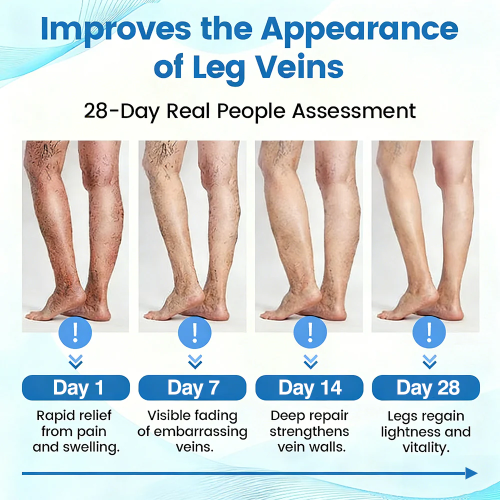 🇬🇧✅GFOUK® VascuCare Vein Healing Spray(Designed for Varicose veins, Spider veins, Deep vein Thrombosis, Chronic venous insufficiency, Venous ulcers, Thrombophlebitis and other venous issues) - Image 12